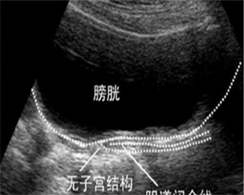 辅助生殖